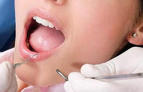 營(yíng)養(yǎng)與牙齒的關(guān)系-四川種植牙廠(chǎng)家