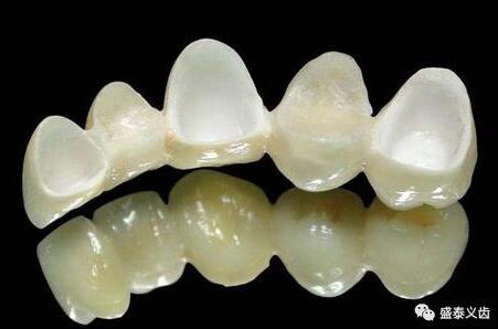 氧化鋯全瓷牙解讀大全(有圖有真相)