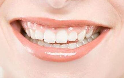 種植牙技術(shù)修復(fù)缺失牙齒的優(yōu)勢有哪些-四川種植牙廠家