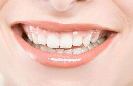 種植牙技術(shù)修復(fù)缺失牙齒的優(yōu)勢(shì)有哪些-四川種植牙廠家