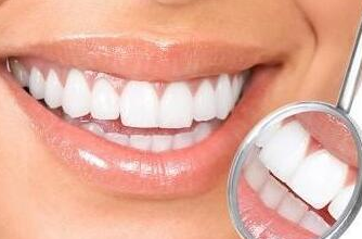 牙列美需用一生來(lái)維護(hù)-成都種植牙廠家