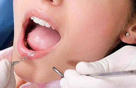 營養(yǎng)與牙齒的關系-四川種植牙廠家