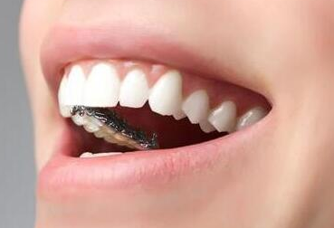 做種植牙修復(fù)脫落牙齒的優(yōu)點(diǎn)有哪些-成都種植牙廠(chǎng)家