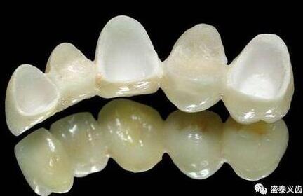 氧化鋯全瓷牙解讀大全(有圖有真相)