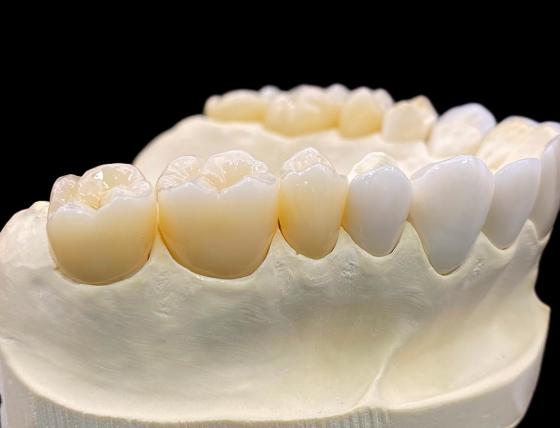 種植假牙涉及到的醫(yī)療器械 | 成都義齒廠家