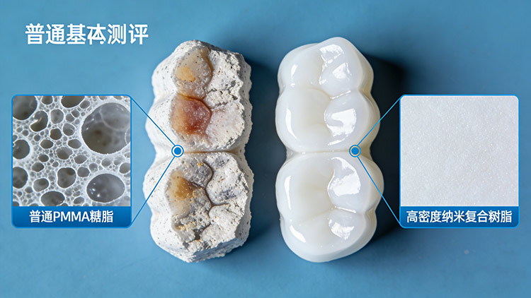 義齒發(fā)黃、松動(dòng)、有異味？成都義齒廠家解析三大問(wèn)題根源與應(yīng)對(duì)方案